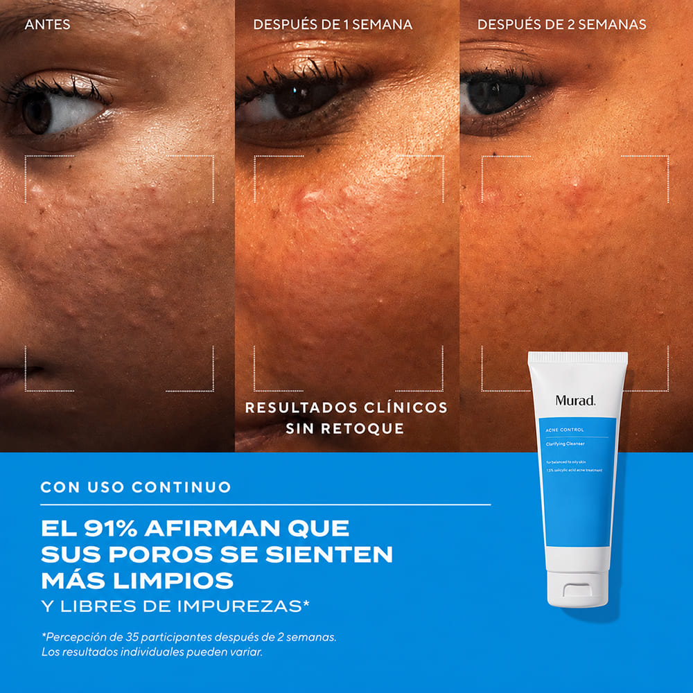 CLARIFYING CREAM CLEANSER (LIMPIADOR FACIAL ANTIACN&Eacute;)